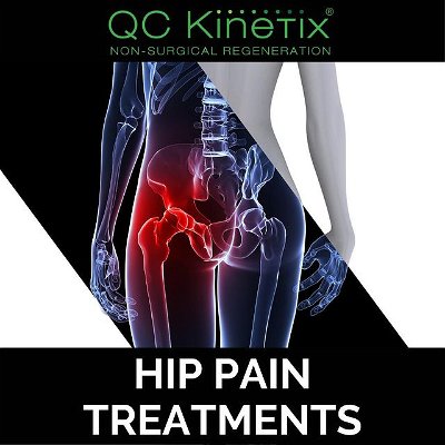 Typical pain with osteoarthritis of the hip joint presents itself in the groin area of the affected side. Pain can be exacerbated by both internal and external rotation of the hip. At QC Kinetix, we can address hip pain due to osteoarthritis and other conditions with orthobiologic injections.

To learn more about our treatments of hip pain, give us a call at 208-425-2747.