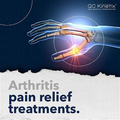 Arthritis is not a single disease: it refers to joint pain and several forms of joint disease. There are over 100 types of arthritis and related conditions. These conditions can have rapid onset symptoms or can be gradually degenerative. While arthritis is more common in older women than men, the condition can also be triggered at any age by injuries, such as torn ligaments or bone fractures.

Visit our website to learn more about arthritis pain relief treatment at QC Kinetix! Link in bio 🩺