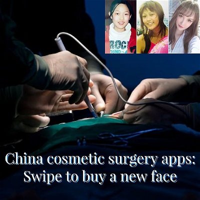 A growing number of Chinese women are using cosmetic surgery to achieve bigger eyes, high cheekbones, narrow noses and skinny legs. In 2014, more than 7 million Chinese people had plastic surgery, according to the China Association of Plastics and Aesthetics. Just three years later, data suggests the figure was closer to 16.3 million. Many of the Chinese women having cosmetic surgery are young and living in second and third tier cities. Internet culture and photo apps like Meitu have made plastic surgery more desirable.

Being pretty is a way to ensure you will be successful at work and find a husband, experts say. Beauty apps that match patients with surgeons and clinics are popular in China. GengMei has 36 million users and lists almost 20,000 surgeons on its platform. One such clinic is high up in One Pacific Place, a luxury office block in central Hong Kong. Double eyelid surgery is the most popular procedure for young Chinese women.

Lip fillers are used to plump up cheekbones, make a chin pointier or even heighten a nose. The faces of Angelababy and Fan Bingbing have been used as references for young cosmetic surgery devotees.

Some Chinese cosmetic surgery patients have started to move away from celebrity ideals. One popular look is an M-shaped lip with a dimple in the middle, according to the app GengMei. Beijing has started to crack down on unlicensed and unqualified clinics. China is catching up to the United States in terms of the total number of cosmetic procedures performed. By 2023, total revenue is expected to exceed 360 billion yuan ($52 million), according to So-Young's prospectus.

Source:
#linkinbio

Credits:
Written by Julie Zaugg | Contributors: Stella Ko, CNN, Natalie Leung
Video by Julie Zaugg
Photos by Chandan Khanna, Wu Xiaochen

#beauty #beautiful #beautytips #beautyclinic #beautifulgirls #beautytreatment #confidence #selflove #loveyourself #makeup #plasticsurgery #cosmetic #lips #eyelids #nose #face #hair #hairstyle #style #fashionmodel #modelling #model #pretty #viral #instagram