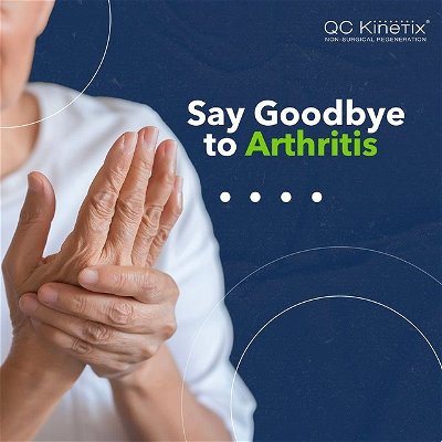 Arthritis is a chronic disease affecting the joints — the places where bone meets bone and movement occurs.

QC Kinetix takes a unique approach to providing arthritis pain relief. Our non-surgical methods for treating arthritis go to the source of your pain, employing a variety of natural and biologic treatments to deliver genuine arthritis pain relief.

Schedule a consultation today! Link in bio.

#QCKinetix #EmmittSmith #regenerativemedicine #tissueengineering #healthcare #health #science #medicine #aging #wellness #neuroscience #nanotechnology #sciencenews #regenerative #paralysis #medicalresearch #chronicpain #stemcelltreatment #kneepain #backpain #osteoarthritis #arthritis #jointpain #pain #health #knee #running #rehab #painrelief #exercise
