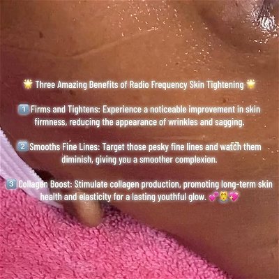 You might recognize this gem if you’ve ever had a facial by either myself or @sweeties_skin_therapy. Take your facial massage to the next level with RF therapy. Don’t hesitate to ask us to add this in your next facial ❤️
 #RadioFrequencySkinTightening #YouthfulSkin #GlowingComplexion #BeautySecrets #albanynyskincare #colonieny #518beauty