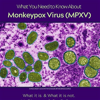 Amid the recent rise in Monkeypox virus cases and subsequent declaration of monkeypox as a public health emergency by the Biden administration, we want to equip you with the information you need. Be careful, wash your hands and stay healthy as we return back to school!
•
#monkeypox #monkeypoxvirus #monkeypoxoutbreak